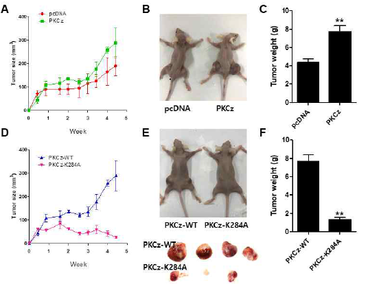 PKCz 수모억제과발현 세포 이식 누드마우스에서 항암효과