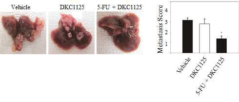 인간 대장암세포 HCT116을 이용한 간전이 모델에서 DKC1125 화합물의 전이억제효과 확인