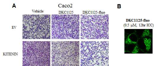 암전이억제 후보물질 DKC1125의 세포 내 위치확인