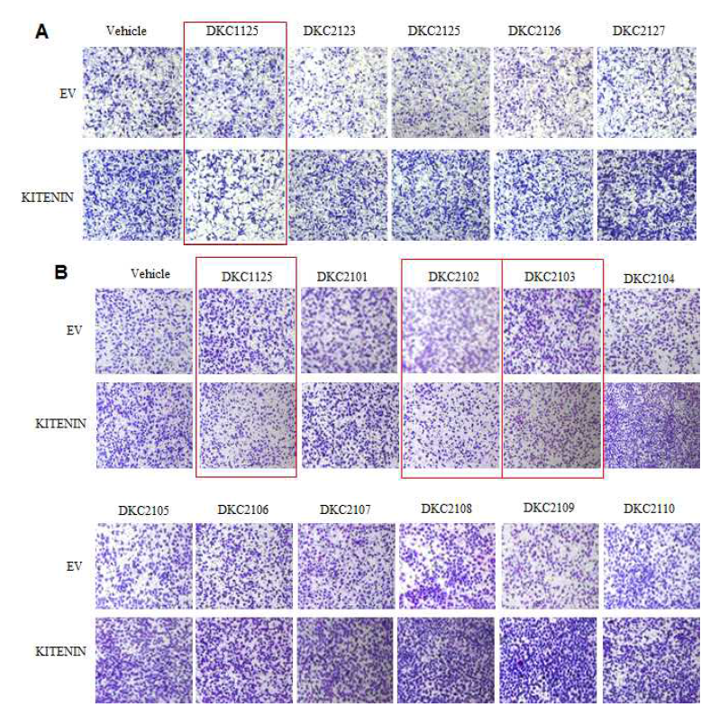 암전이억제 후보물질 DKC1125 합성유도체의 in vitro 세포침윤 억제효과 비교