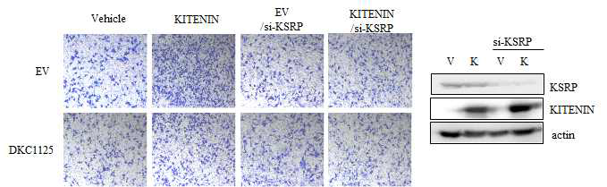 DKC1125 화합물이 가지는 KITENIN 과발현에 의한 세포침윤성 증가 억제효과에 대해 si-KSRP 효과