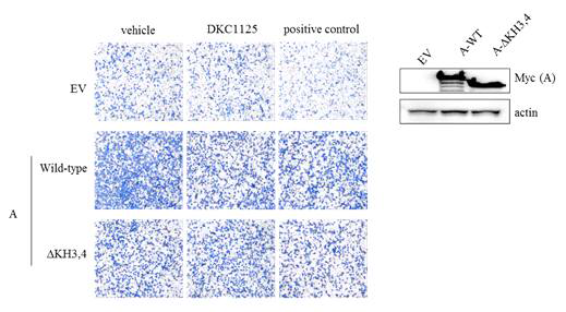 Wild-type 및 ΔKH3,4-KSRP 과발현 상태에서 DKC1125에 의한 세포침윤성 억제 효과