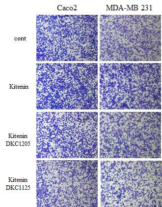 DKC1125, DKC1205 화합물이 KITENIN 과발현에 의한 암세포 침윤 증가 억제
