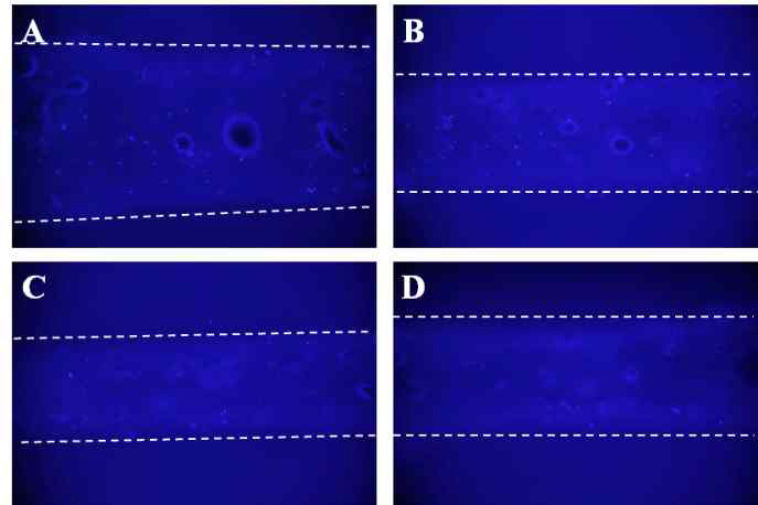 NIH 3T3가 혼합된 Poloxamer 407/Silk fibroin 입자 프린팅 속도별 DAPI 분석