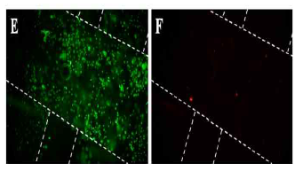 NIH3T3와 혼합된 Poloxamer 407/Silk fibroin 입자의 프린팅 직후 Live/Dead 염색 관찰 결과 E) Green=Live cell, F) Red=Dead cell