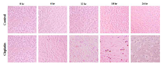 약물 처리후 24시간동안 세포의 형태적 관찰 결과