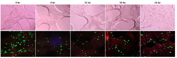 GelMA와 HeLa Cell 3D 프린팅후 Cisplatin 약물 반응 관찰