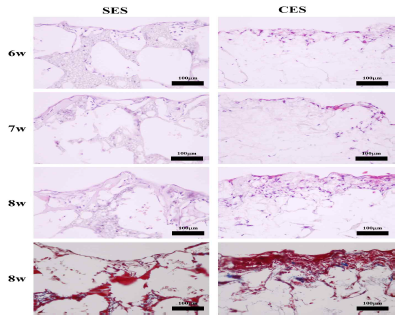 Keratinocyte 및 Fibroblast를 coculture 하여 인공 피부 지지체의 Histology