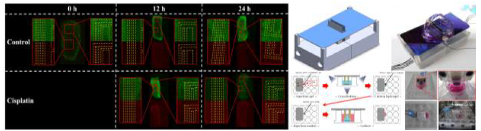 Hela cell의 3D 배양 및 프린팅 후 Cisplatin에 대한 측정을 위한 3D 하이브리드 센서 제작 개발