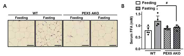 지방세포 특이적 PEX5 결손 생쥐 표현형 분석