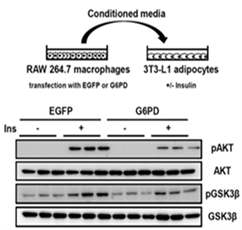 대식세포 내 G6PD가 지방세포의 인슐린 민감도에 미치는 영향