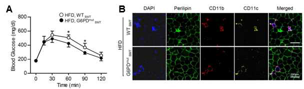 대식세포 G6PD가 지방조직 염증반응 및 전신 에너지대사에 미치는 영향