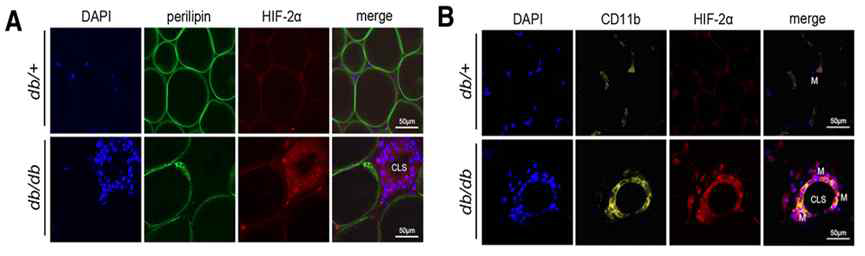 비만 생쥐의 지방조직 대식세포에서 HIF-2α 발현 증가