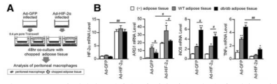 HIF-2α가 과발현된 대식세포에 의한 지방조직 내 염증반응 변화