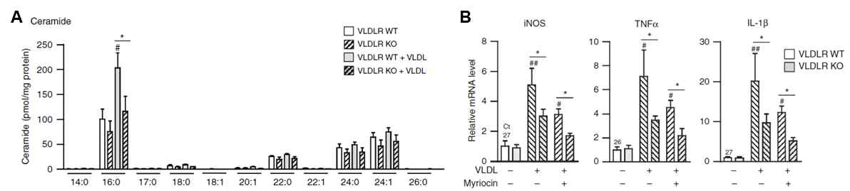 대식세포에서 VLDL-VLDLR 경로 활성화에 의한 ceramide 축적 및 염증반응 증가
