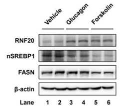PKA 활성화시 RNF20와 SREBP1c 단백질 양적 변화