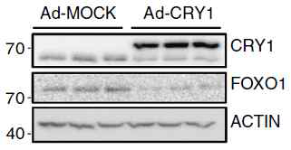 CRY1 과발현에 의한 FOXO1 단백질 변화