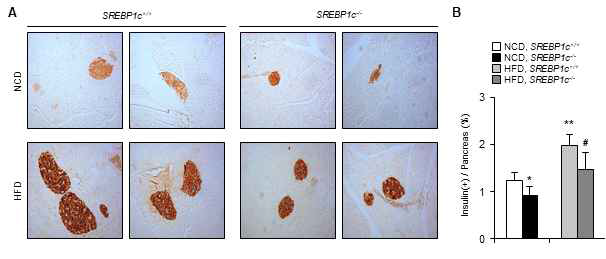 SREBP1c 결손에 따른 췌장 세포섬 영역 감소