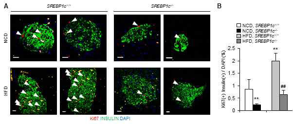 SREBP1c 결손에 따른 베타세포의 분열능력 감소