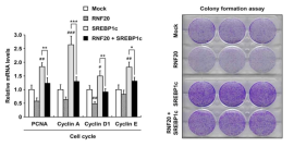 RNF20-SREBP1c 축에 의한 세포 주기 유전자 발현 및 콜로니 형성 능력 변화