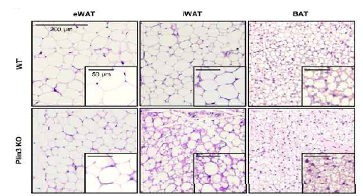 Plin3 결손 생쥐에서의 지방세포 형태 변화