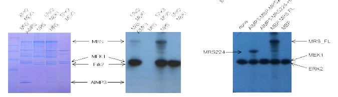 Phosphorylation of MRS. ERK2에 의한 full-length MRS와 N-말단 도메인(MRS224)의 인산화