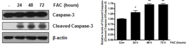 신경세포에서 FAC에 의한 세포자살 인자
