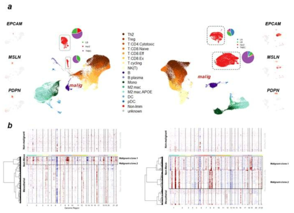 CNV 추정을 이용한 비면역계 세포군의 양성/악성 판별 분석 (a) UMAP상에서의 비면역계/악성종양세포의 마커 유전자 발현 패턴 (b) 추정된 CNV 패턴, EH 환자 샘플 (좌), SNUH 환자 샘플 (우)