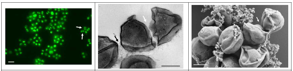 (A). 고세균 strain MY3의 FISH 염색 이미지 (B). 고세균의 TEM 이미지 (C). 고세균의 SEM 이미지