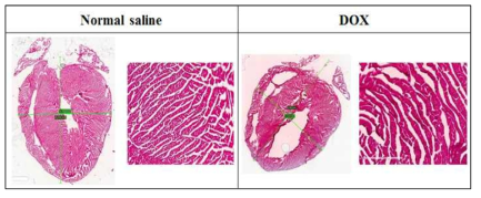 ICR 마우스에 1주 1회 6주간 독소루비신 5 mg/kg (DOX, n=4) 또는 normal saline (n=4)를 투여한 후 마지막 투여 24시간 후 심장 조직 cryosection 결과