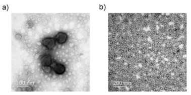 a) 인플루엔자 바이러스와 b) 6SL-PEI 1.8K-Ce6의 투과전자현미경 사진