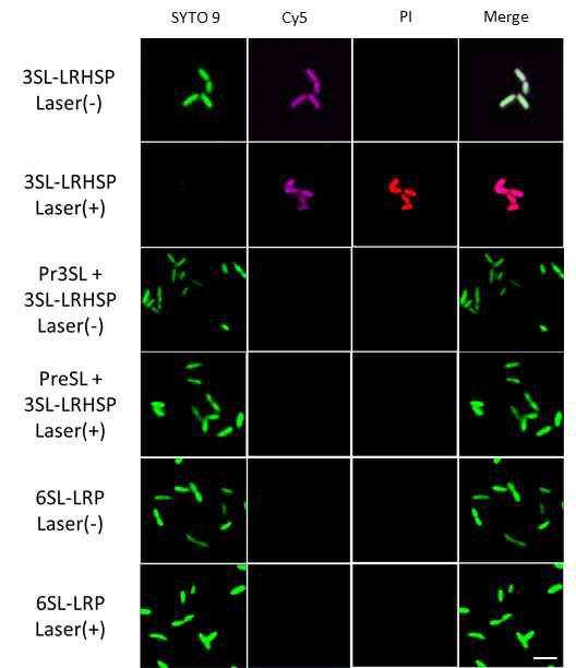 Pheophorbide a(Pheoa) 0.5 ug/ml, In cubation time : 30 min, H.pylori 1*106 bacteria/ ml, Scale bar : 5 μm, Laser (+) : 2.4 J/cm2(50 mW x 48 sec), Laser (-) : No laser irradiation, 3SL-LRHSP : Butyl-poly(3SL-lysine)10-PPA, 6SL-LR HSP: Butyl-poly(6SL-lysine)10-PPA, Pre 3SL : pretr eatment 3