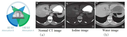 (a) 이중에너지 스캔의 원리 (b) 일반 의료 영상 및 물질 분해 알고리즘을 통한 체내 물질(요오드, 근육) 영상