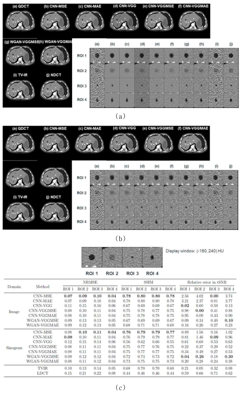 노이즈 저감 영상 및 정량적 지표 (a) 이미지 도메인, (b) 사이노그램 도메인, (c) 정량적 지표