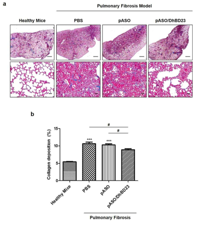 (a) Masson’s trichrome 염색 기법을 활용하여 폐섬유화 치료 효과 관찰. (b) 이미지 분석을 통해 collagen deposition 정량 분석 (3 세부과제에서 진행)