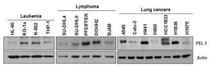 다양한 암 세포주에서 PEL-1 단백질 발현 레벨 확인