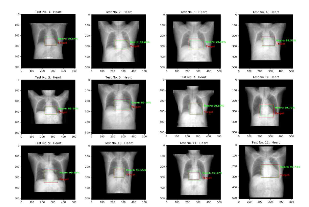 1st Stage: Detection Model의 심장검출 성능평가에 대한 시각적 확인