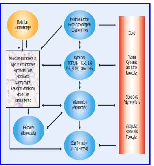 방사선 치료후 나타나는 폐부작용 (Fibrosis)의 대표적 진단 (Cytokine 측정 및 SNP 검사) 및 치료법 (Semin Oncol, 2005)
