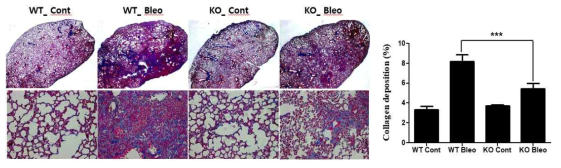 CTSS KO inhibited BLM-induced pulmonary fibrosis. Masson's Trichrome staining from lung tissues of BLM-treated CTSS wild type (WT) and knock out (KO) mice was performed. Magnification, x12.5 (upper) and x200 (bottom)