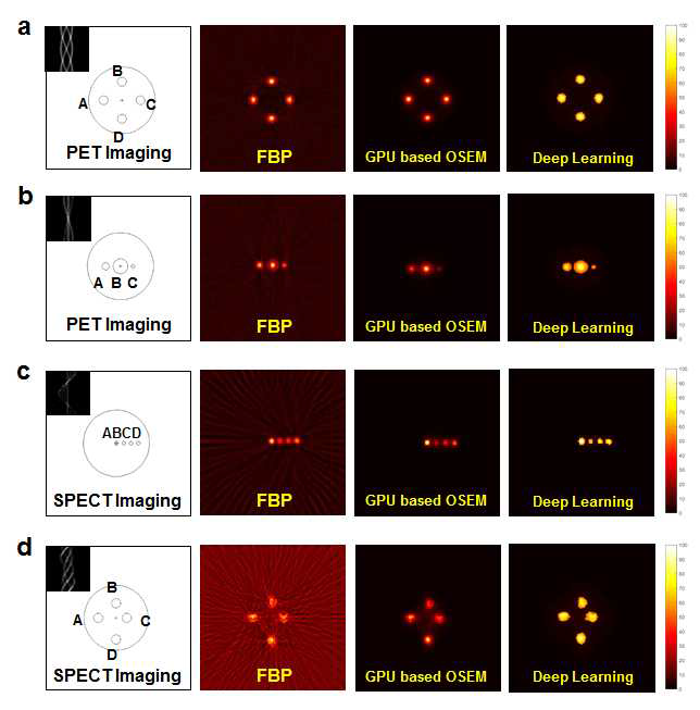 가로라인을 기준으로 (a)와 (b)는 PET에 대한 영상을, (c)와 (d)는 SPECT에 대한 영상을 나타내며, 첫 번째 세로라인은 팬텀에 대한 실제 단면 영상이며 팬텀 내 영역 별로 A, B, C, (D: 4개의 경우)로 태그 되어 있음. 또한 왼쪽 상단에 각 시뮬레이션 상 영상기기로부터 도출된 사이노그램이 표지되어 있음. 두 번째 세로라인은 필터역투사(FBP) 영상으로 SPECT의 경우 역투사영역의 필터처리로 인한 star artifact가 나타남. 전반적으로 필터역투사 영상은 경계 부분에 있어서 명확함은 있지만, 노이즈레벨이 높아 정확한 진단을 하는데 장애가 될 수 있음. 세 번째 세로라인은 GPU기반 반복적 영상 알고리즘을 이용하여 획득된 영상으로 영상 상의 artifact를 비롯한 노이즈는 필터역투사 영상과 비교했을 때 획기적으로 줄어들었지만 경게가 모호하고 크기가 상대적으로 작은 방사선원의 경우 신호의 세기가 약해 분간이 어려운 영상도 볼 수 있음. GPU와 부분집합을 이용한 사이노그램 리딩으로 영상 획득 시간은 획기적으로 단축시켰음. 마지막 세로라인은 딥러닝 기반의 영상으로 영상 상의 노이즈는 GPU 기반 반복적 재구성 영상과 비교해도 전혀 손색이 없을 정도로 낮지만 반복적 재구성 영상보다 경계가 뚜렷하고 크기가 큰 영역에서는 물론, 작은 영역에서의 신호 세기 또한 분간이 확실히 될 정도로 신호의 세기가 우수하여 이상적인 핵의학 영상에 가깝게 결과가 도출되었음을 확인 할 수 있었음
