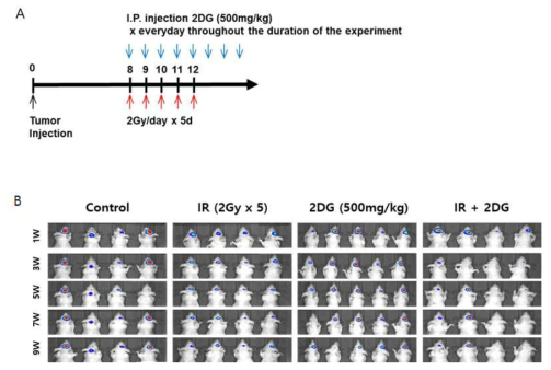 방사선 (2Gy/day x 5d) 조사와 2DG (500mg/kg)를 병용 투여 했을 때의 tumor growth 확인