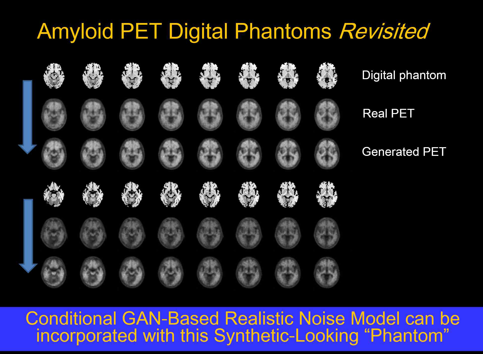 Amyloid PET Digital Phantoms Revisited