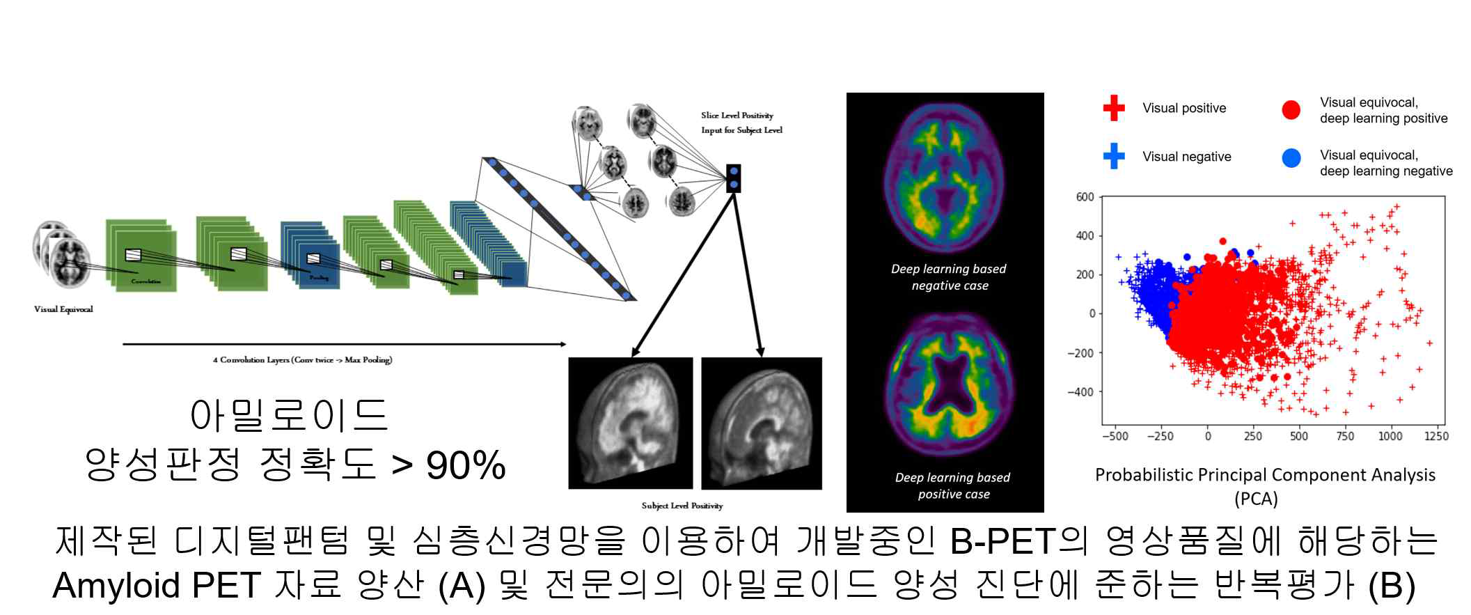 Brain PET의 영상품질에 해당하는 자료의 양산과 진단 반복평가