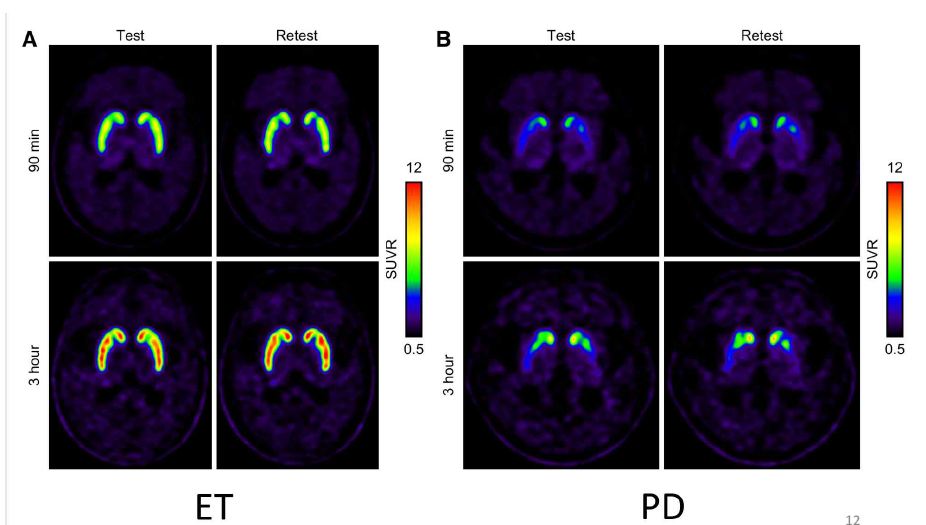 Representative SUVR images of 90-min and 3-hour test-retest [ FLSUP18 ] FP-CIT PET