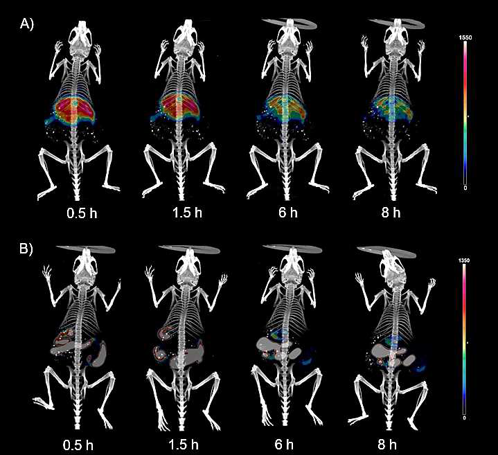 99mTc-E. Coli 체내 영상화(SPECT/CT) 결과 A) 정맥 주사, B) 구강 투여