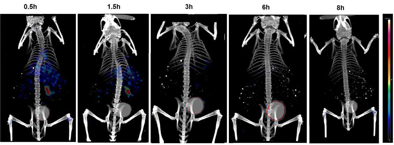 99mTc(CO)3 정맥 투여 시 체내 영상화(SPECT/CT) 결과