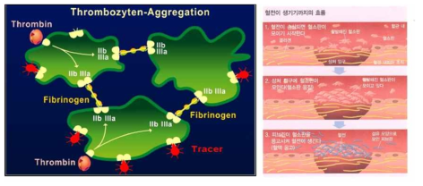 혈전 생성을 위한 활성화된 glycoprotein IIb/IIIa가 혈액섬유소에 결합이 발생되어 혈전이 생성되는 과정 모식도 (좌) , 혈전 생성 메커니즘 (우)