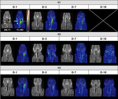 오른쪽 경동맥 혈전 모델 제작 후 D-1, 3, 7 & 10일째 개체별 [18F]GP-1 PET/MRI 영상 결과 2 hr 동적 영상 중 100-120 분 정적 영상