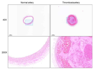 오른쪽 경동맥 혈전 모델 제작 후 normal artery와 H&E 염색결과 비교