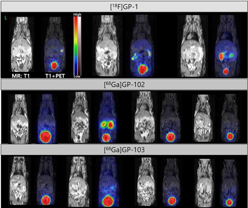 정상 마우스 모델에서 [18F]GP-1 PET/MRI 영상에서 110-120 분 정적영상과 [68Ga]GP-102 및 [68Ga]GP-103 PET/MRI 영상에서 50-60 분 정적 영상